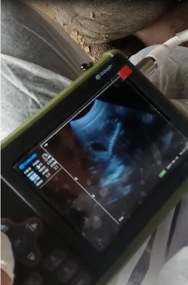 醫用b超,動物b超,醫用b超機,動物b超機,彩超機