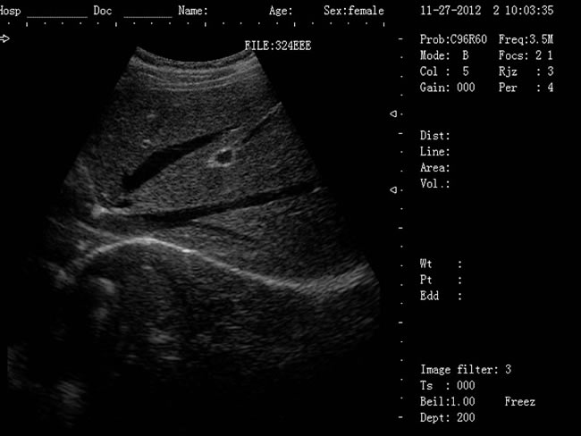 老式的b超機(jī)黑白要多少錢(qián),新型B超機(jī),B超機(jī),黑白B超機(jī)
