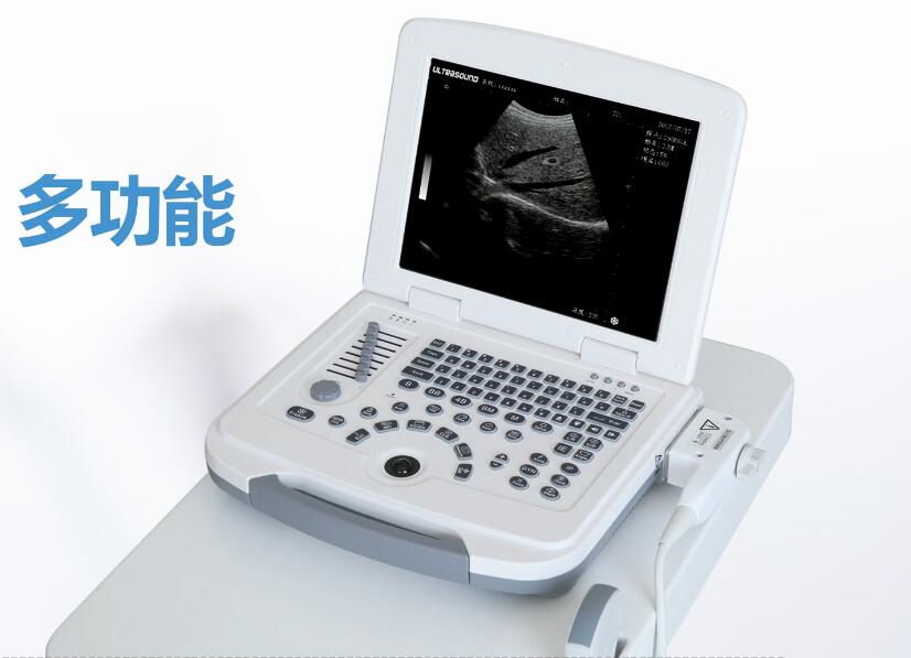 b超機(jī),b超,脂肪肝B超